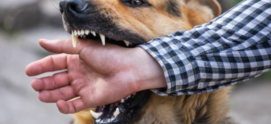 В Тверской области проверяют информацию о нападении собаки на детей в Кимрах