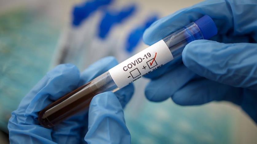 В Тверской области зафиксирован шестой случай заболевания коронавирусом